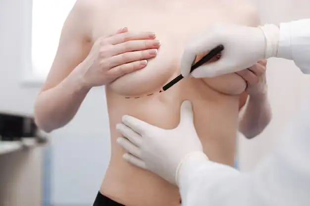 Breast Aesthetics in Turkey 27 Breast Augmentation turkey in istanbul cost