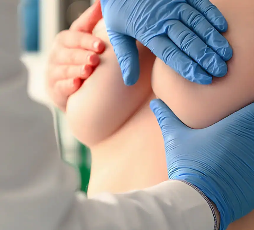 Breast Aesthetics in Turkey 28 meme implanti